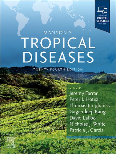 ﻿بیماری های گرمسیری منسون