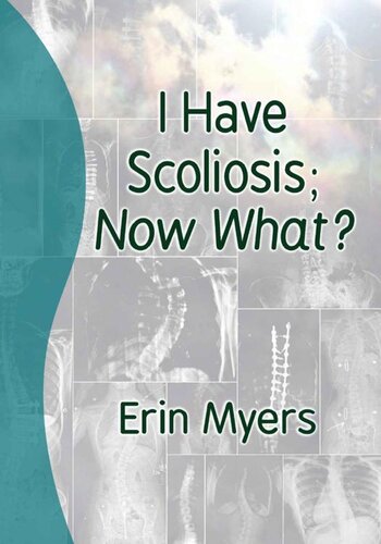 ﻿من اسکولیوز دارم. حالا چی؟
