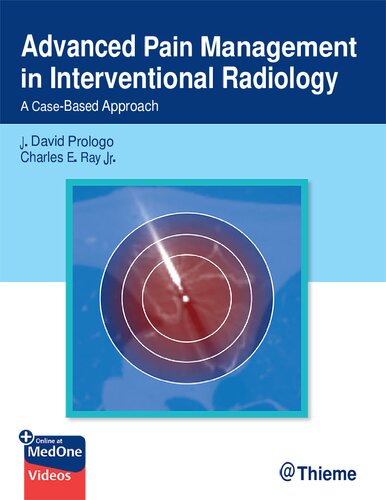 ﻿مدیریت درد پیشرفته در رادیولوژی مداخله ای - رویکرد مبتنی بر مورد (29 دسامبر 2023)_(1684201403)_(Thieme)
