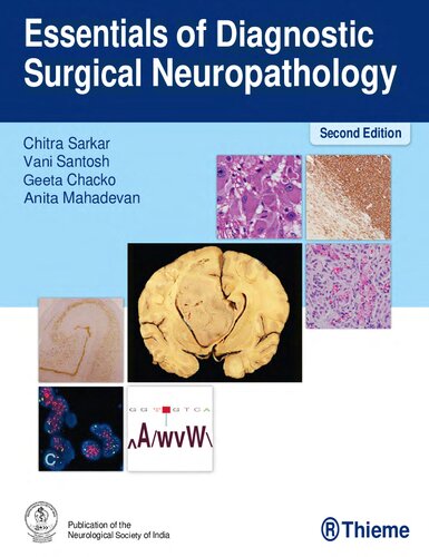 ﻿Essentials Of Diagnostic Surgical Neuropathology, 2e (5 سپتامبر 2023)_(9395390050)_(Thieme).pdf