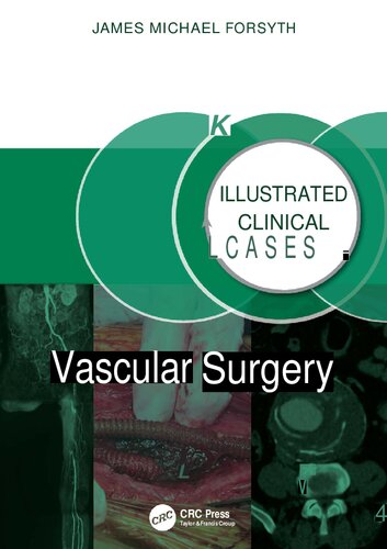 ﻿جراحی عروق