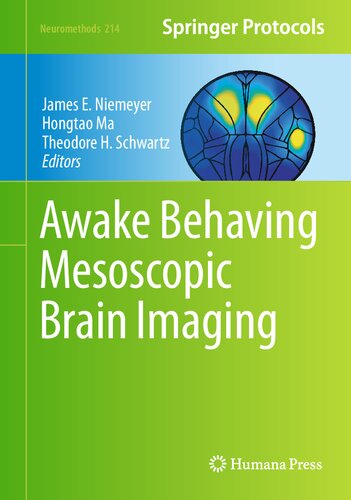 ﻿بیدار شدن از تصویربرداری مغز مزوسکوپی