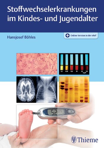 ﻿بیماری های متابولیکی در دوران کودکی و نوجوانی: با نسخه آنلاین در EREF