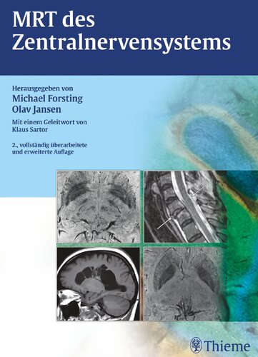 ﻿MRI از سیستم عصبی مرکزی