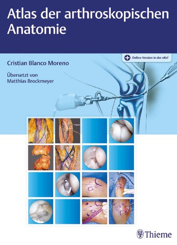﻿اطلس آناتومی آرتروسکوپی