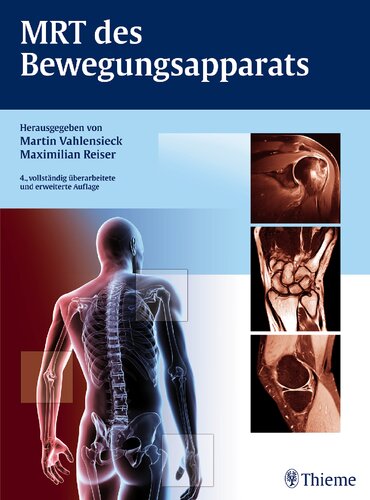 ﻿MRI سیستم اسکلتی عضلانی