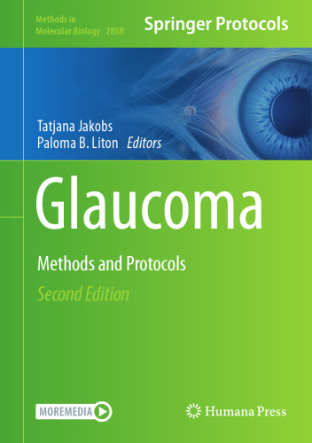 Glaucoma: Methods and Protocols