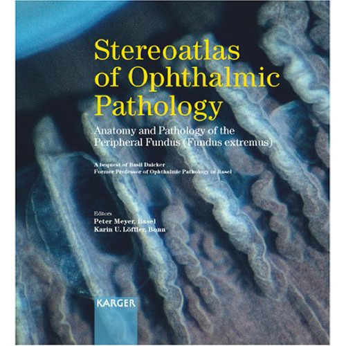 ﻿Stereoatlas of Ophthalmic Pathology: Anatomy and Pathology of Peripheral Fundus (fundus extremus)