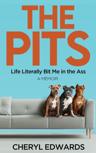 ﻿زندگی چاله ها به معنای واقعی کلمه من را در الاغ گاز می گیرد