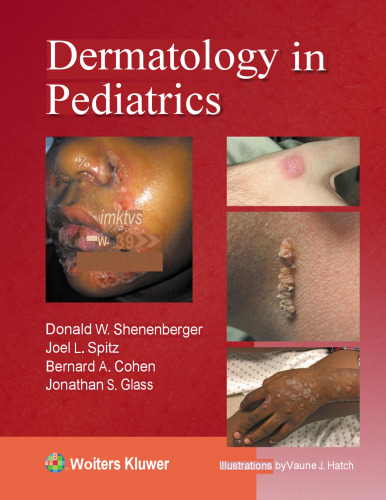 Dermatology in Pediatrics (Aug 7, 2024)_(197523538X)_(LWW).pdf