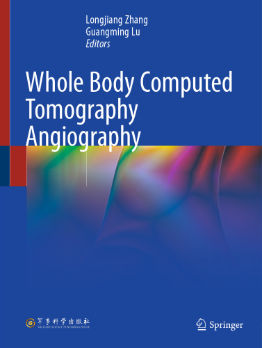﻿آنژیوگرافی توموگرافی کامل بدن