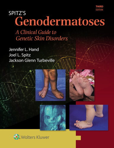 ﻿Genodermatoses Spitz - یک راهنمای بالینی با رنگ کامل برای اختلالات ژنتیکی پوست ، 3E (25 مه 2024) _ (1451116519) _ (LWW) .epub