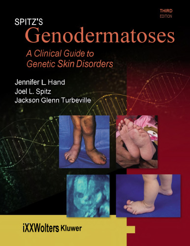 ﻿Genodermatoses Spitz - یک راهنمای بالینی با رنگ کامل برای اختلالات ژنتیکی پوست ، 3E (25 مه 2024) _ (1451116519) _ (LWW) .pdf