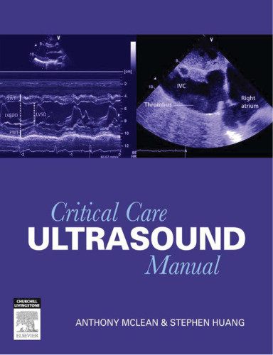 ﻿کتابچه راهنمای سونوگرافی مراقبت های ویژه