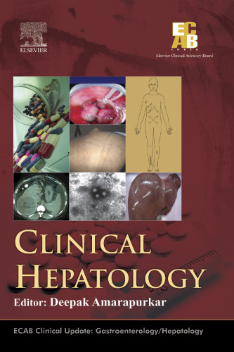 ﻿کبدی بالینی ECAB