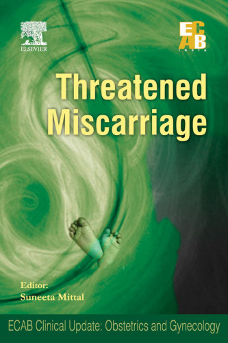 ﻿سقط جنین تهدید شده - ECAB