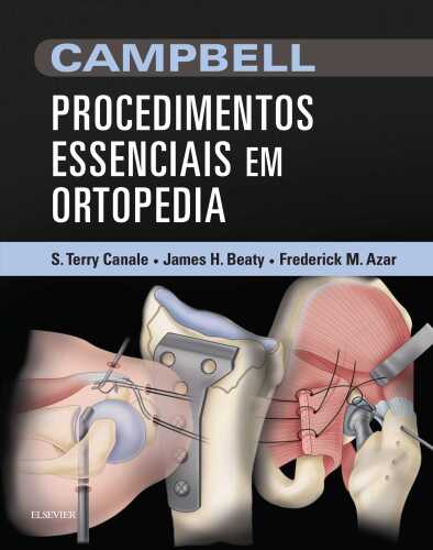 ﻿روشهای ضروری کمپبل در ارتوپدی 1ed