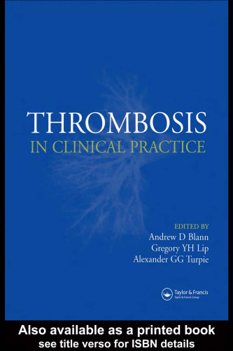 ترومبوز در عمل بالینی