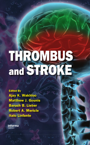 ترومبوز و سکته مغزی (بیماری عصبی و درمانی)