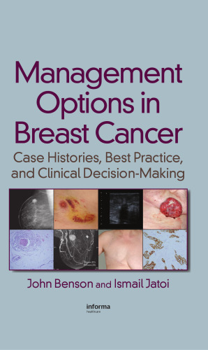 گزینه های مدیریت در سرطان پستان: تاریخچه مورد ، بهترین تمرین و تصمیم گیری بالینی