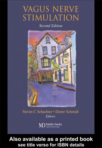 تحریک عصب واگوس