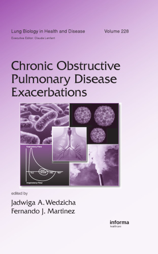 تشدید بیماری انسداد مزمن ریوی (بیولوژی ریه در سلامتی و بیماری)