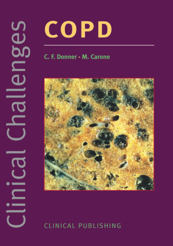 چالش های بالینی در COPD