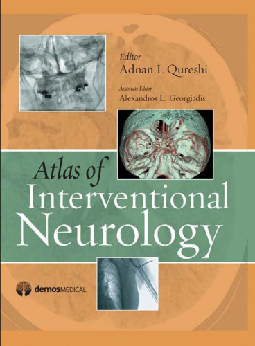 ﻿اطلس مغز و اعصاب مداخله ای