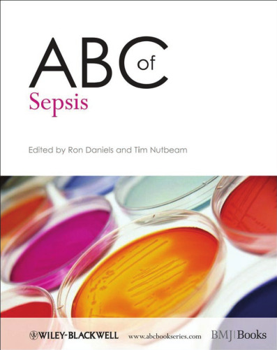 ﻿ABC از سپسیس