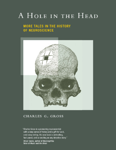 ﻿سوراخ در سر: قصه های بیشتر در تاریخ علوم اعصاب