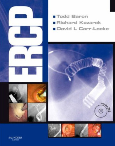 ﻿ERCP