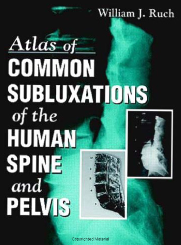 ﻿اطلس سابلوکساسیون های رایج ستون فقرات و لگن انسان