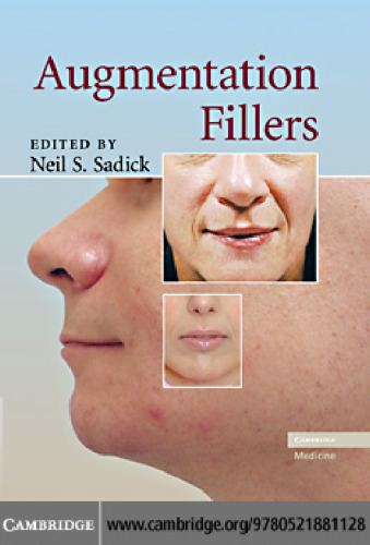 ﻿پرکننده های تقویتی