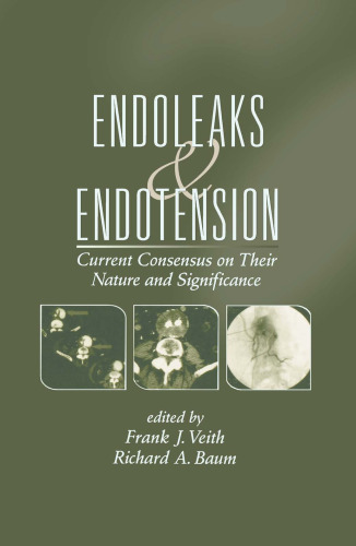 ﻿Endoleaks و Endotension: اجماع فعلی در مورد ماهیت و اهمیت آنها