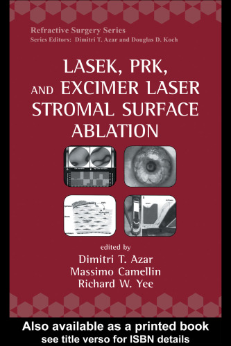 ﻿لیزر ، PRK ، و لیزر Excimer Stromal Surface Ablation (جراحی انکساری)