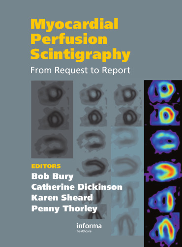 ﻿سینتی گرافی پرفیوژن میوکارد: از درخواست تا گزارش