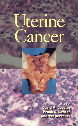 ﻿سرطان رحم