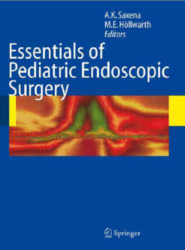 ﻿ملزومات جراحی آندوسکوپی کودکان