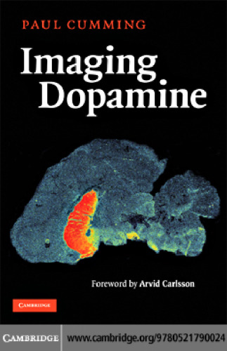 ﻿تصویربرداری از دوپامین
