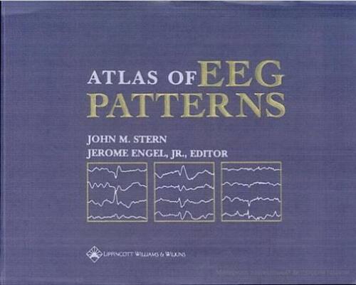 ﻿اطلس الگوهای EEG