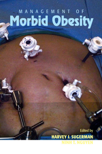 ﻿مدیریت چاقی مرضی