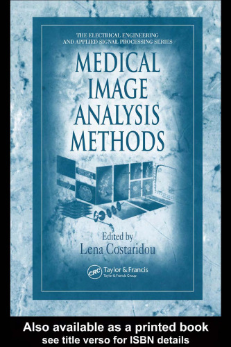 ﻿روش‌های تحلیل تصویر پزشکی (مهندسی برق و پردازش سیگنال کاربردی)