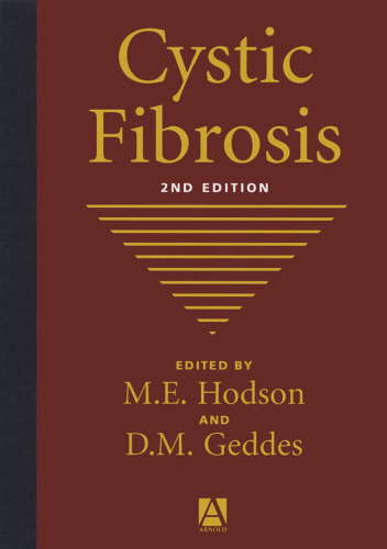 ﻿فیبروز سیستیک