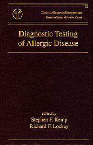 ﻿تست تشخیصی بیماری آلرژیک