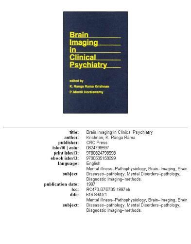 ﻿تصویربرداری از مغز در روانپزشکی بالینی