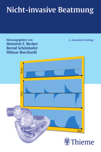 ﻿تهویه غیر تهاجمی ، چاپ دوم