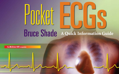 ﻿ECG های جیبی: راهنمای اطلاعات سریع