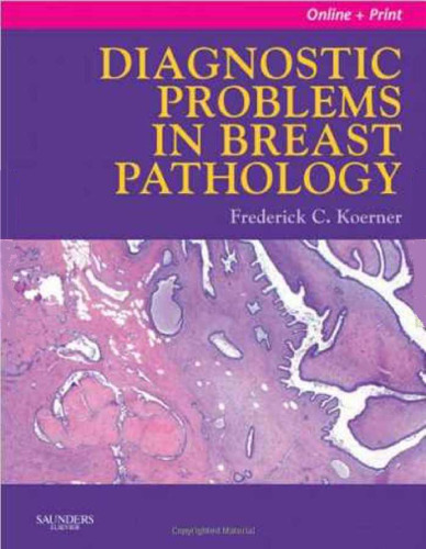 ﻿مشکلات تشخیصی در آسیب شناسی پستان: مشاوره تخصصی: آنلاین و چاپی