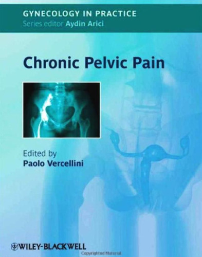 ﻿درد مزمن لگن (GIP - زنان در عمل)