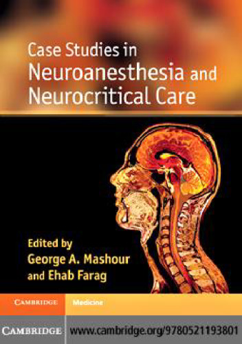 ﻿مطالعات موردی در بی حسی عصبی و مراقبت های عصبی